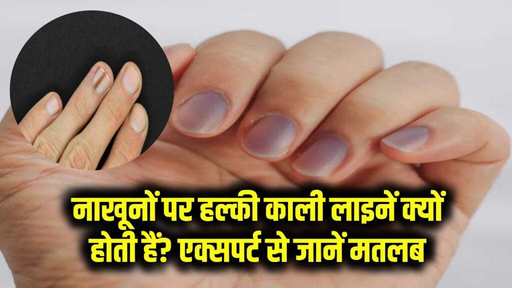 नाखूनों पर हल्की काली लाइनें क्यों होती हैं? क्या है इसकी वजह, जानें एक्सपर्ट से इसका मतलब